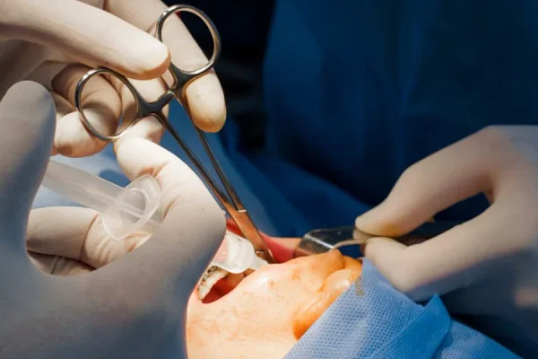 que-es-la-cirugia-oral que-es-la-cirugia-oral